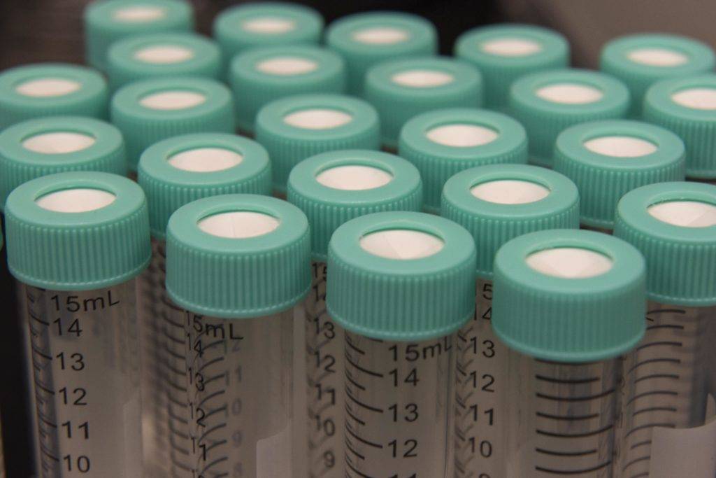 A row of clear plastic test tubes with green caps and measurement markings
